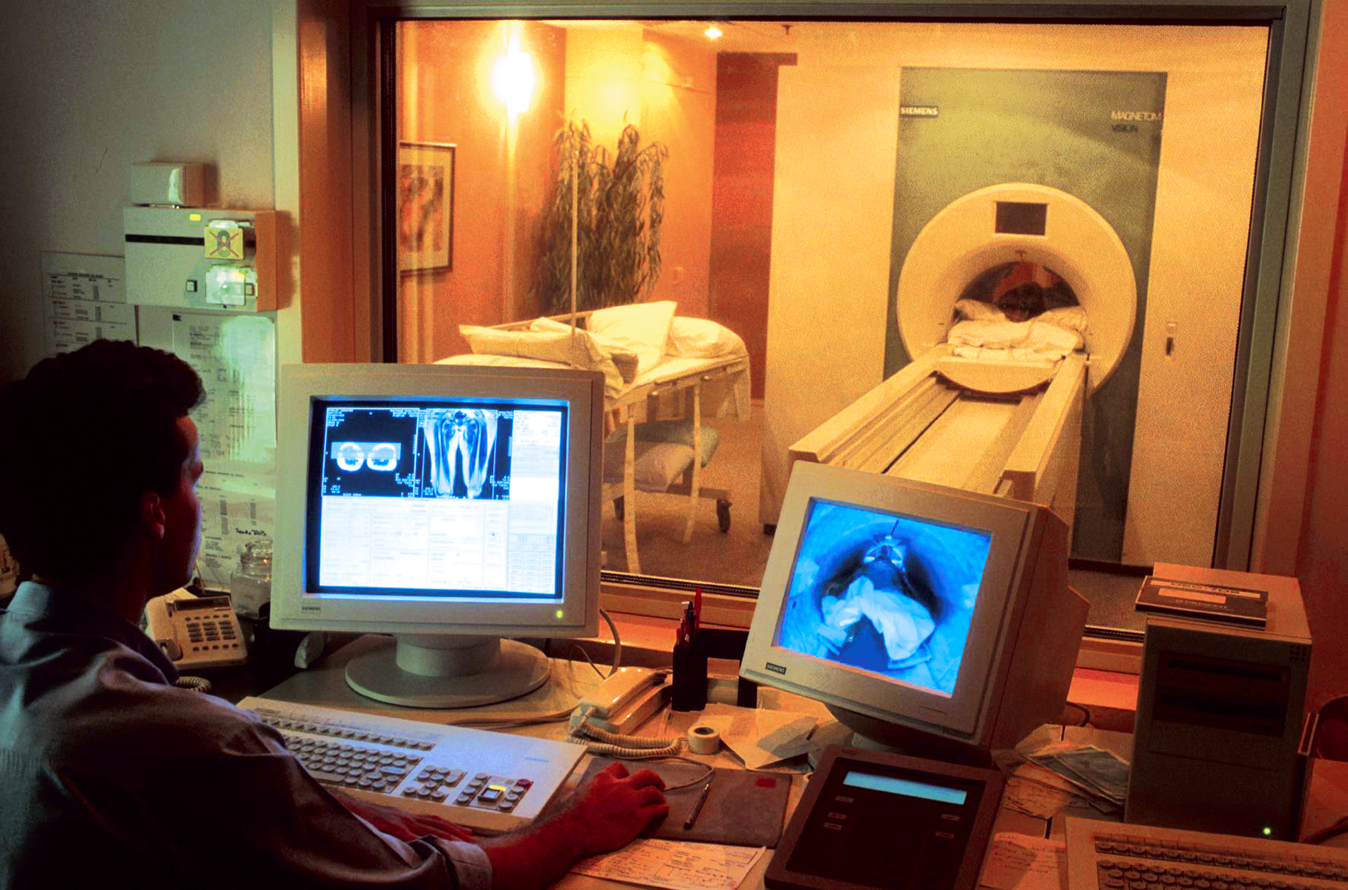 Resonancia magnética cerebral, estudio de neuroimagen